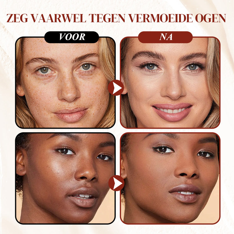 GlowyCorrect™ – Jouw Stralende Oplossing voor Donkere Kringen!