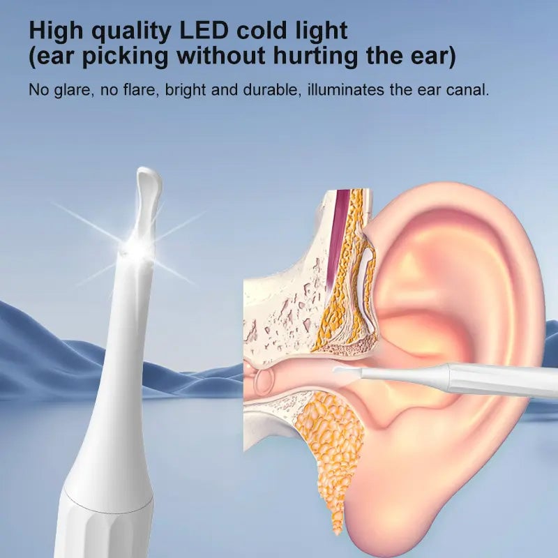 LunaScope™ Earwax Removal Kit