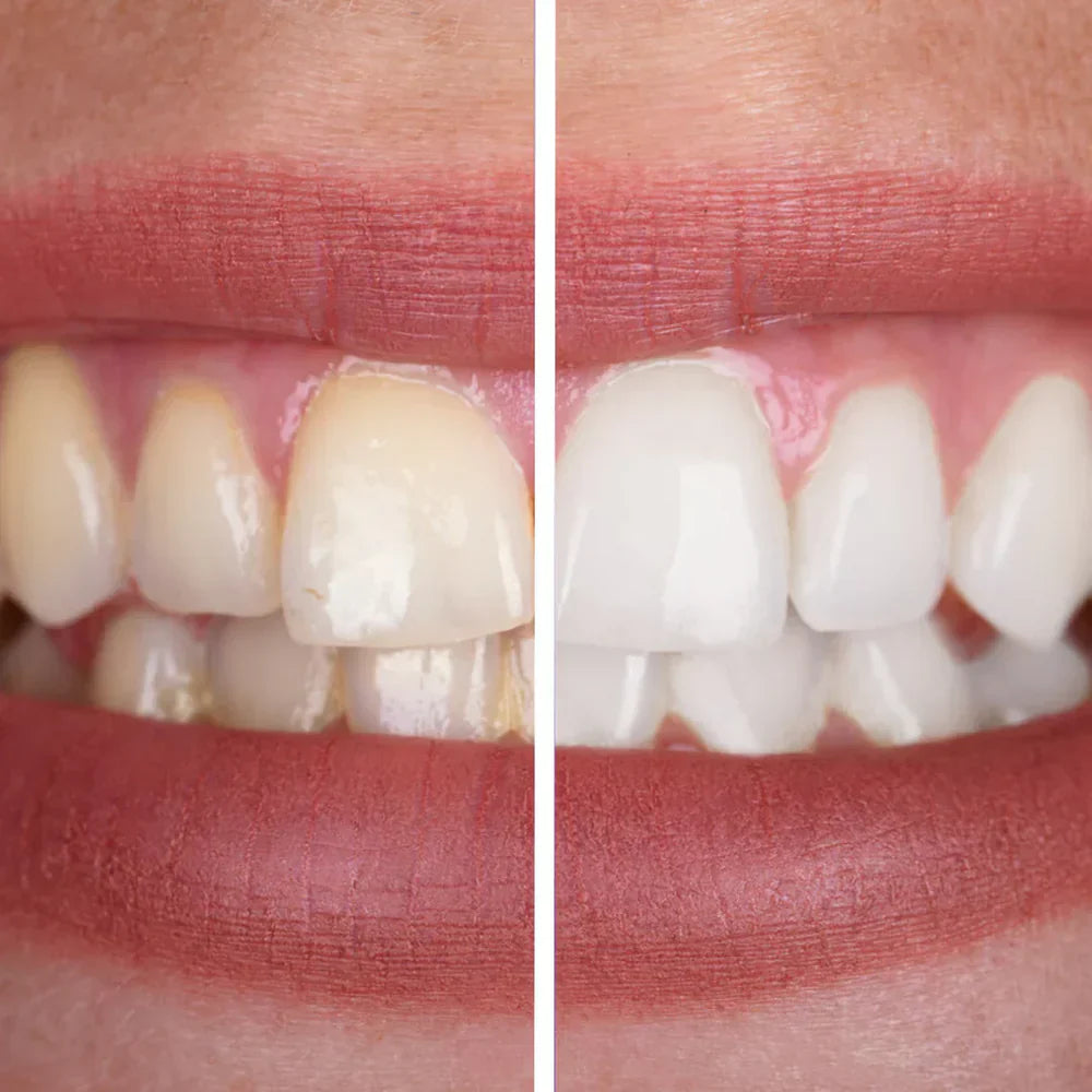 GlowWhite™ | Kleurcorrigerende Tandpasta