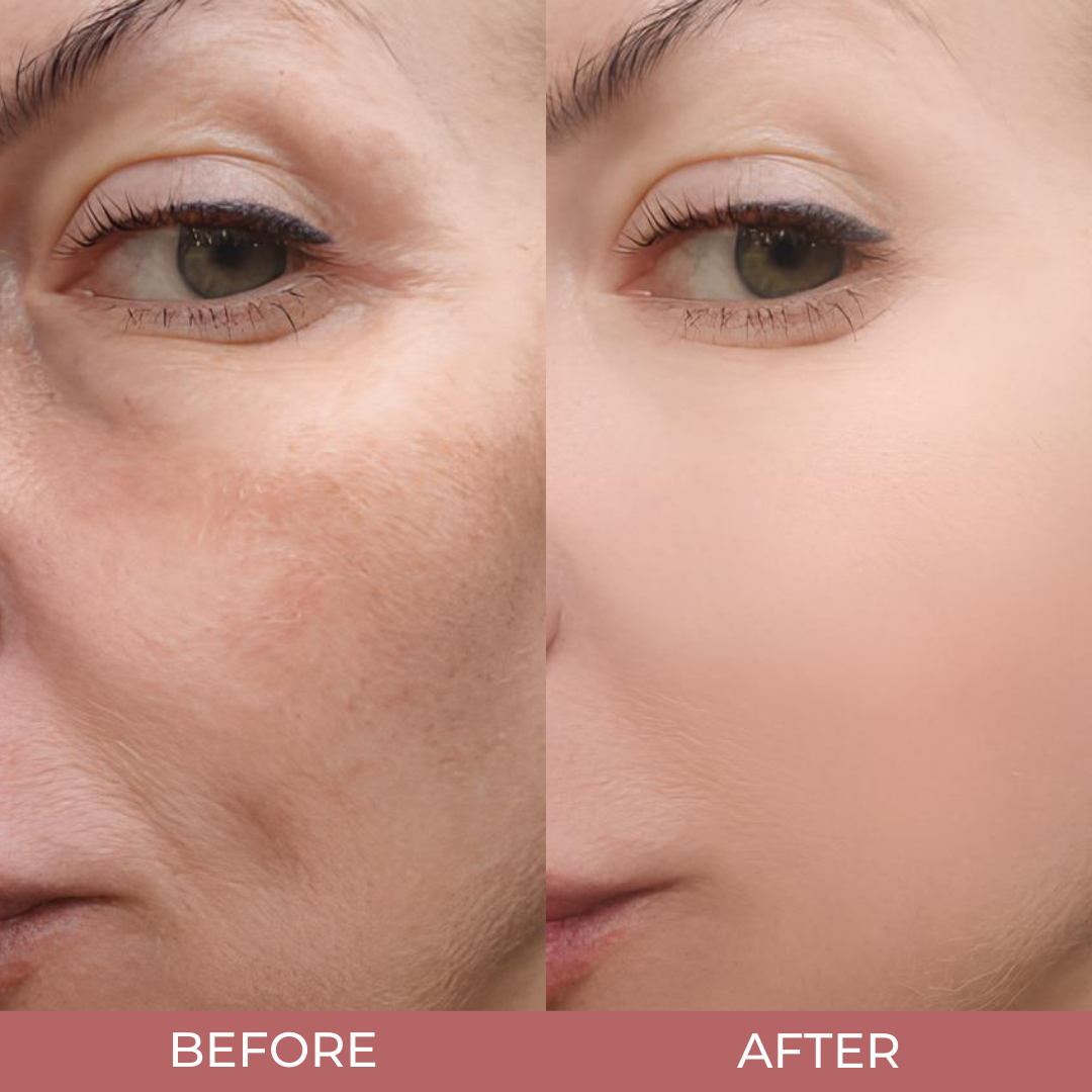 LumiRiz™ Glow Duo