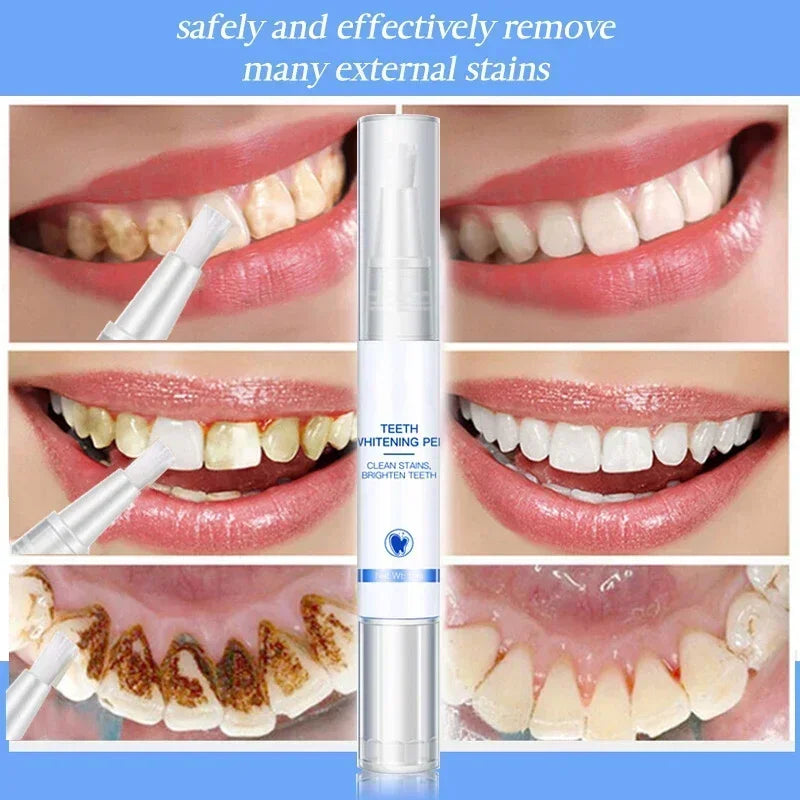 Smilevera™ Tandbleekpen | 1+1 GRATIS