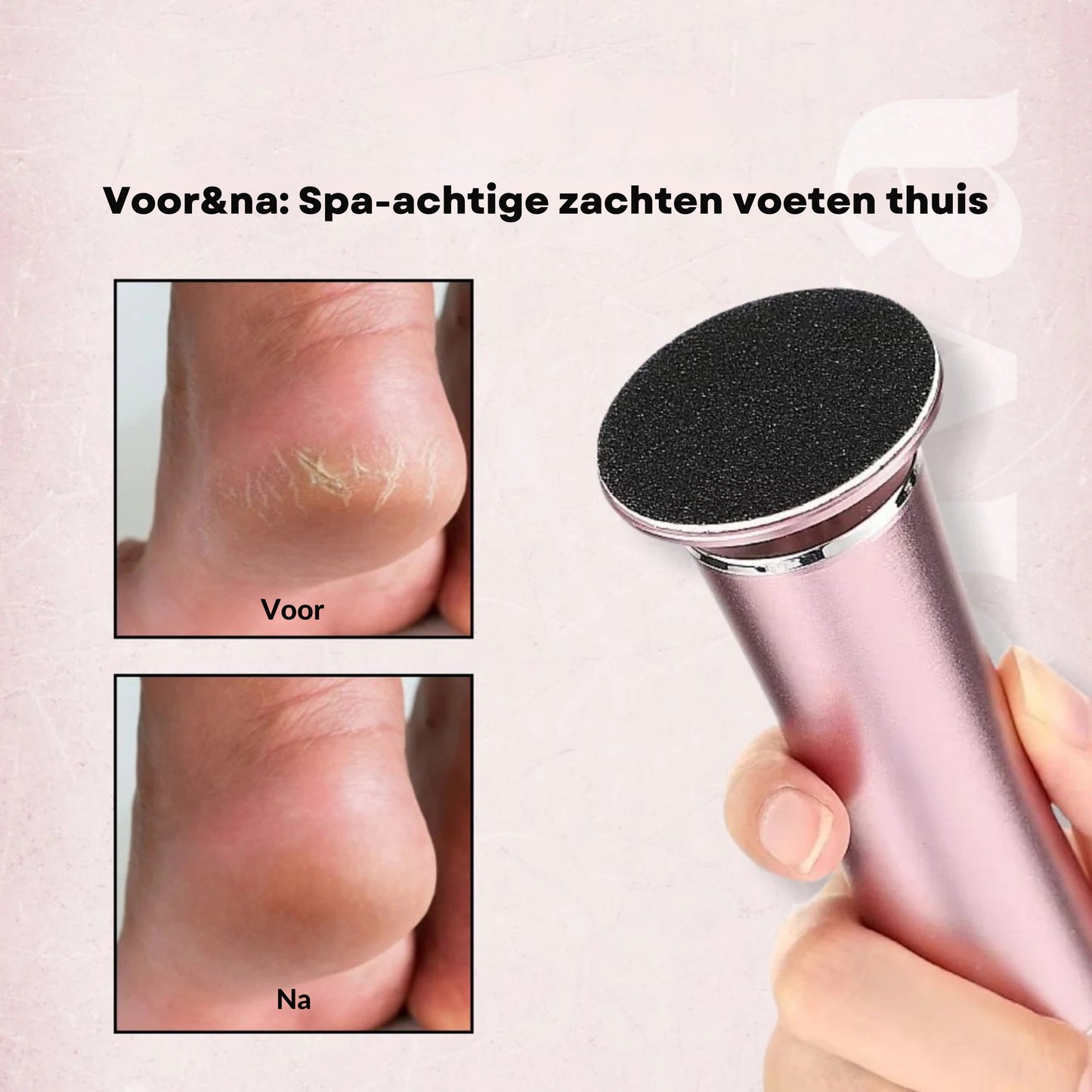 SoleSilk™ Elektrische Voetverzorger