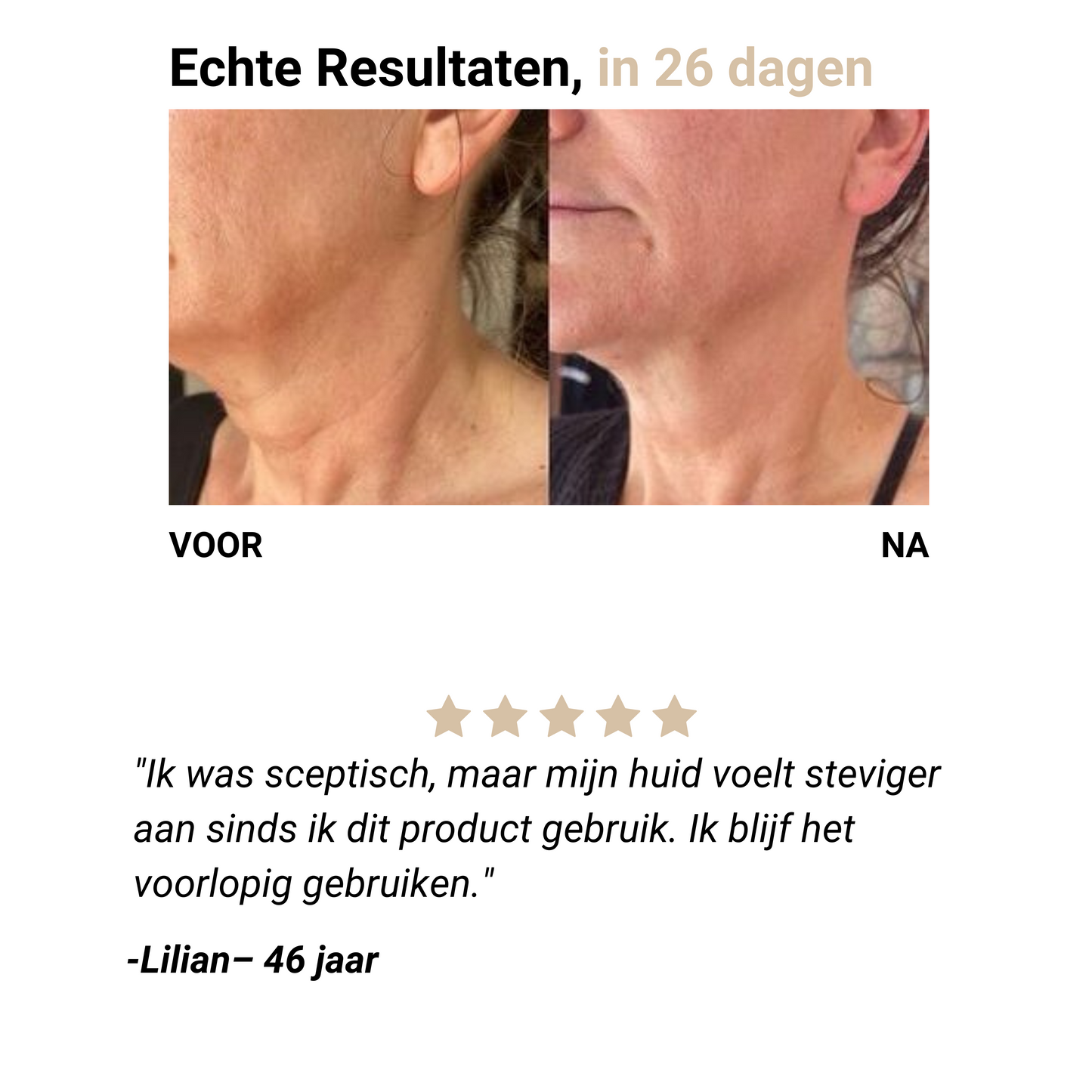 NevaLuxe™ – Halsverzorging Heruitgevonden