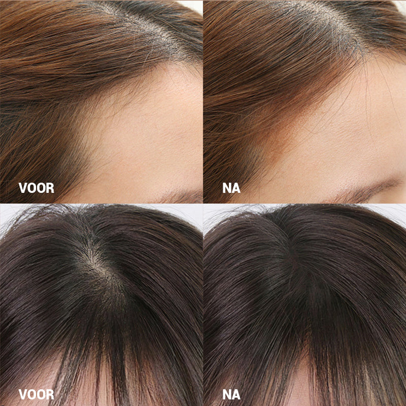 HaarlijnWonder™ - Voor een mooie Haarlijn, Altijd en Overal | 1+1 GRATIS