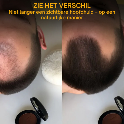 CrownFix™ – Direct voller haar, zonder gedoe | 1+1 GRATIS