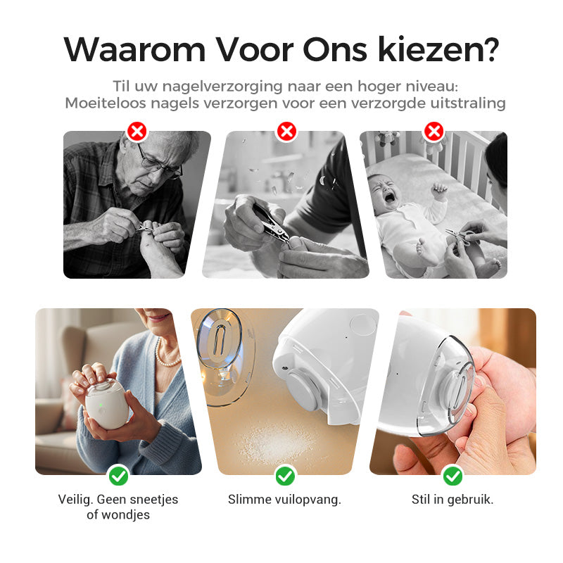 VeloraTrim™ Universele Automatische Nagelvijl voor Volwassenen en Kinderen