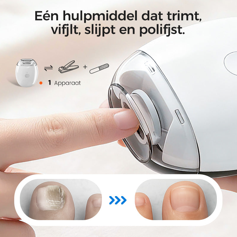 VeloraTrim™ Universele Automatische Nagelvijl voor Volwassenen en Kinderen