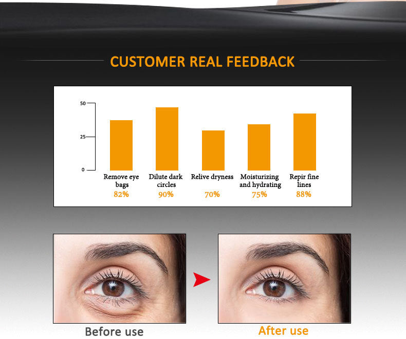 LumiSculpt™ – Direct strakke, egale huid zonder filter | 1+1 Gratis