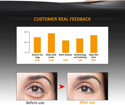 LumiSculpt™ – Direct strakke, egale huid zonder filter | 1+1 Gratis