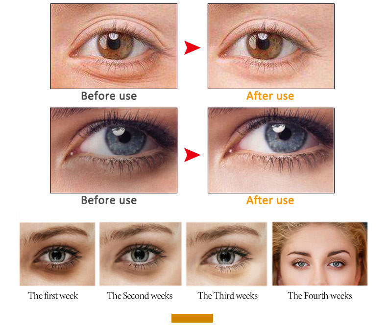 LumiSculpt™ – Direct strakke, egale huid zonder filter | 1+1 Gratis