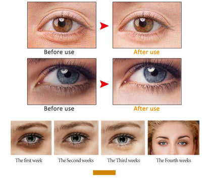 LumiSculpt™ – Direct strakke, egale huid zonder filter | 1+1 Gratis
