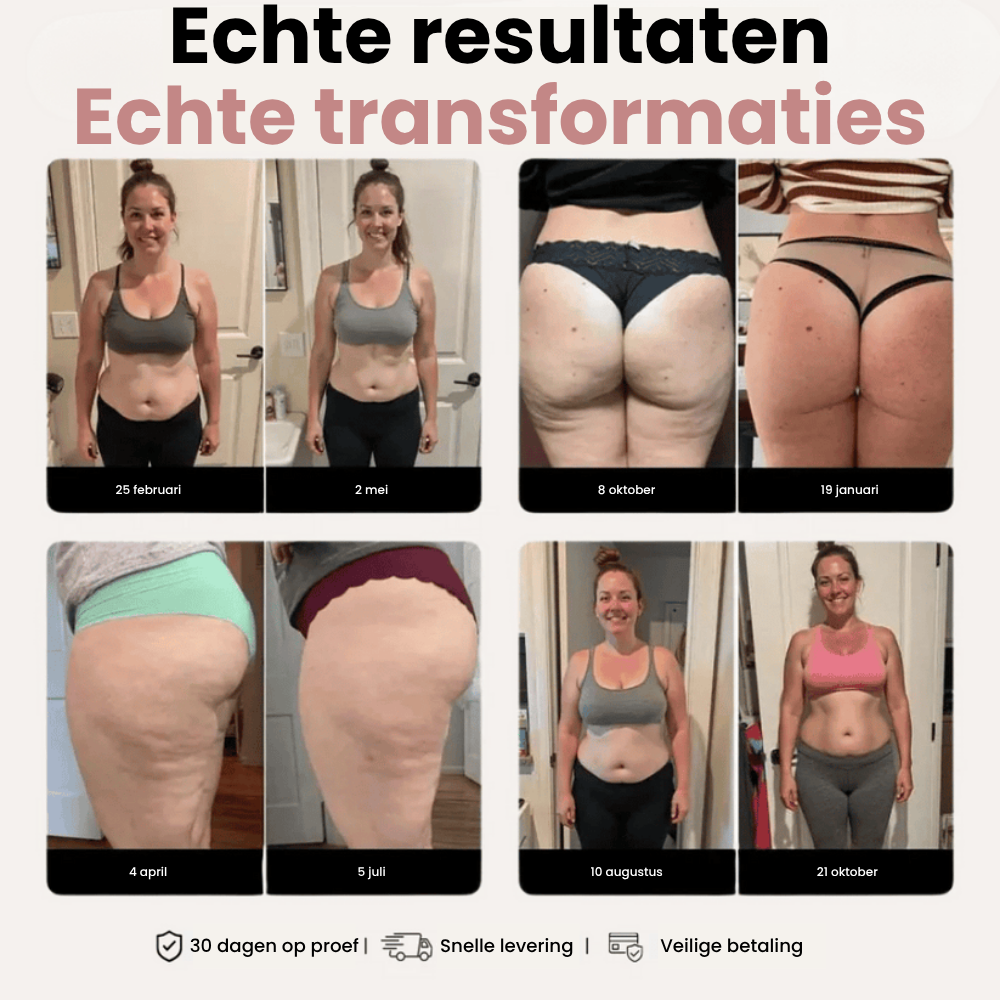 Flexura™ High-Waist Fitness Leggings | 1+1 Gratis