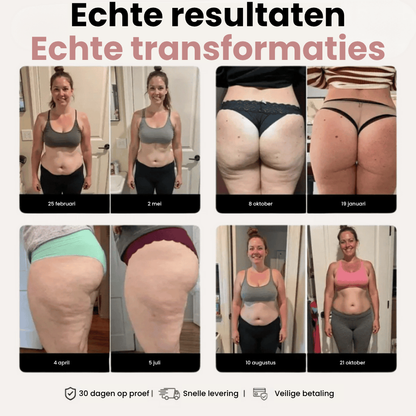 Flexura™ High-Waist Fitness Leggings | 1+1 Gratis