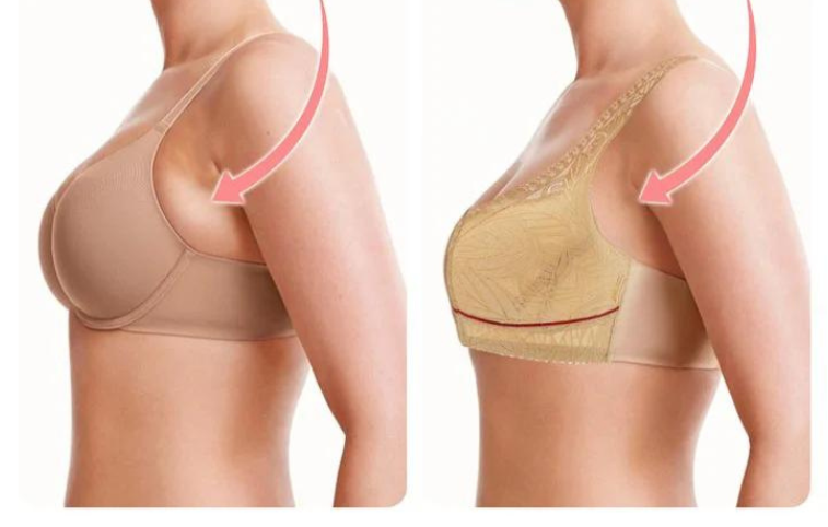 EaseLift™ – De Voorsluit Lift BH die Comfort en Stijl Combineert | 1+2 GRATIS
