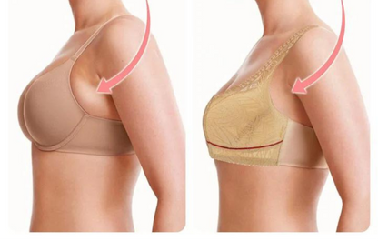 EaseLift™ – De Voorsluit Lift BH die Comfort en Stijl Combineert | 1+2 GRATIS