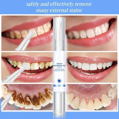 Smilevera™ Tandbleekpen | 1+1 GRATIS