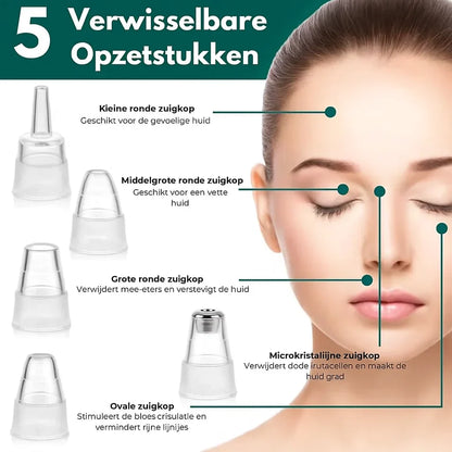 PureSkin Pro™ – Vacuüm Mee-eter Verwijderaar voor een Frissere Huid