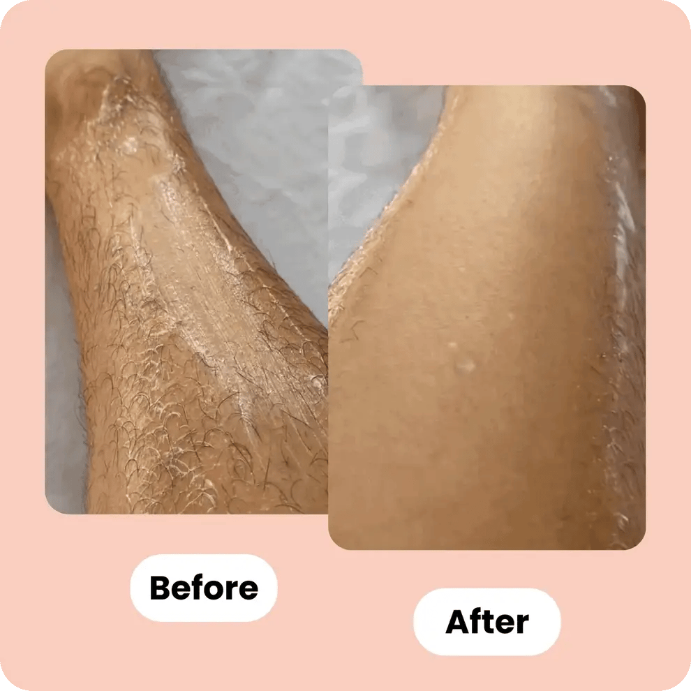 Nazo™ - Veiligheids Scheermes | 1+1 GRATIS|