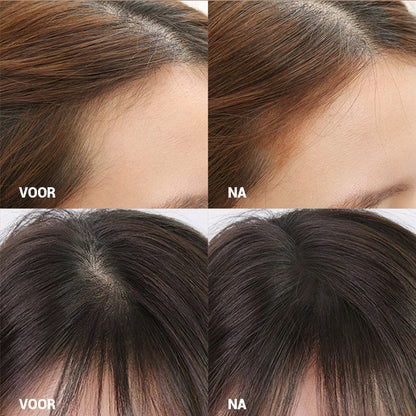 HaarlijnWonder™ - Voor een mooie Haarlijn, Altijd en Overal | 1+1 GRATIS