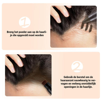 HaarlijnWonder™ - Voor een mooie Haarlijn, Altijd en Overal | 1+1 GRATIS
