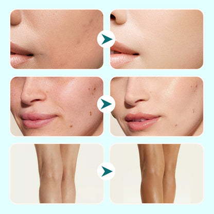 EclatDerm™ Hydraterende & Waterbestendige Concealer Crème | 1+1 Gratis