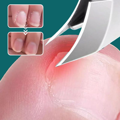 ClipGuard™ 3-in-1 Nagelverzorgingsset – Slim, Hygiënisch & Efficiënt