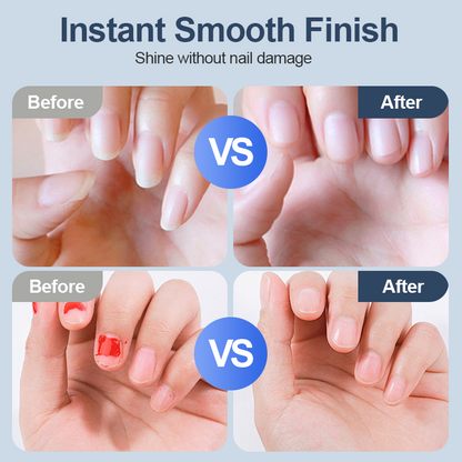 LumiNail Ease™ – De Slimme en Zachte Manier om Nagels Te Verzorgsen